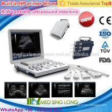 MSLPU33-I ordinateur portable B / W ecocardiogrammes à ultrasons avec haute résolution rotatif 15 pouces écran LED